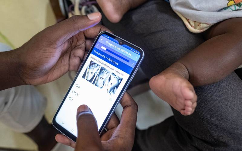 Scaling Global Health Programs: A MiracleFeet Case Study
